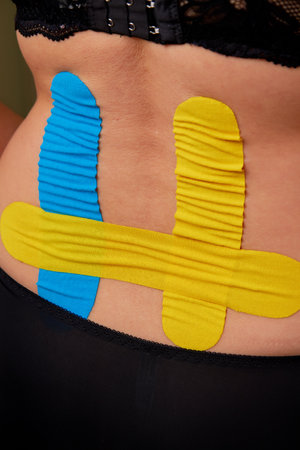Closeup view of female back with applied colorful elastic therapeutic tapes. Kinesio taping for pain relief in lumbar spine.の写真素材