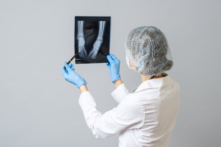 Female doctor examining x-ray image of legs of newborn baby. Isolated over gray backgroundの写真素材