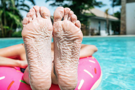 Woman showing feet got wrinkly from stayed in a pool so longの写真素材