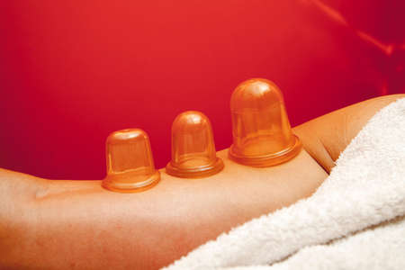 Anti cellulite massage Ventuza body pullers, close-up