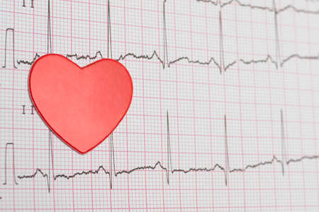 Electrocardiogram to measure heart rate. ECG. Heart lies on the cardiogram. Caring for the health of...