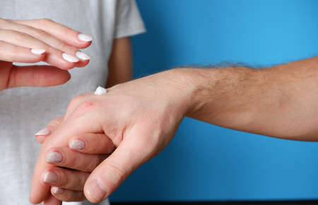 Hand skin care. The woman put the cream on man's weathered hand.