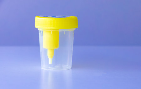 A plastic container for urine sample with a yellow lid sits on a blue table. The container is empty. Concept of medical analyticsの写真素材