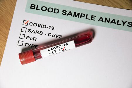 Result Form Blood sample test tube positive with COVID-19 or novel coronavirusの写真素材