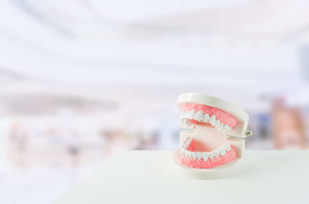 Close up of white teeth model with red gum and dental mirror on blur backgroundの写真素材