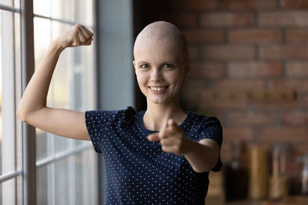 Portrait of young sick hairless woman struggle with cancer show strength power beating disease, happy ill female patient point at screen, feel optimistic strong battling oncology, healthcare conceptの写真素材