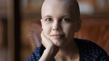 Close up portrait of happy young Caucasian hairless bald woman patient with cancer look at camera show strength power, positive optimistic sick female suffering from oncology, healthcare conceptの写真素材