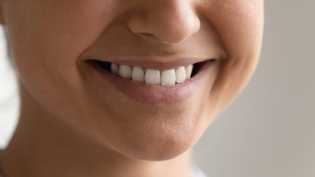 Hollywood smile. Cropped close up of smiling young female face. Unknown millennial lady get perfect...