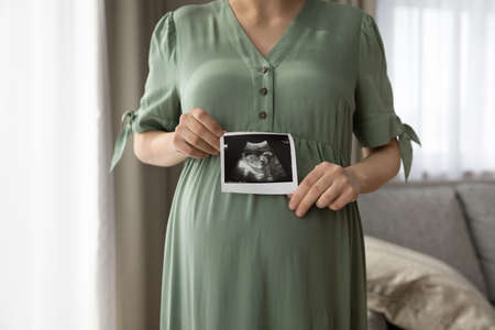 Close up cropped of pregnant woman in green dress showing ultrasound picture at camera, standing at...