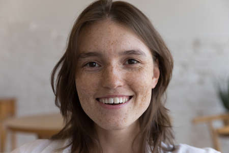 Freckled face of happy teen girl without makeup looking at camera. Cheerful young woman with spotted facial skin, fresh complexion, toothy smile close up head shot portrait. Natural beauty conceptの写真素材