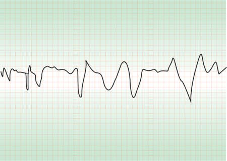 cardiology testのイラスト素材
