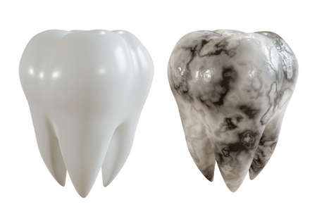 Comparison image of a healthy tooth and a caries patient. 3D Rendering.の写真素材