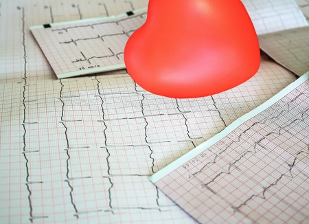Cardiogram with small red heart on the table background. Top view, copy spaceの写真素材