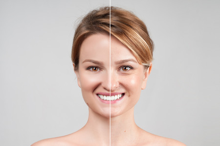 Concept of skin rejuvenation. Woman before and after cosmetic or plastic procedure, anti-age therapyの写真素材