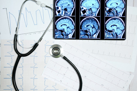 Doctor workplace with medical stethoscope and tablet display .の写真素材