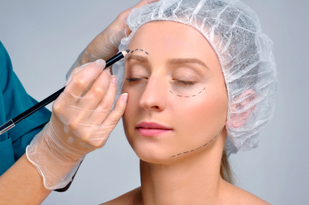 Plastic surgery. Woman with dotted lines on the face. Anti-aging treatment and face lift, doctor's hands drawing perforation lines on over eyebrowの写真素材