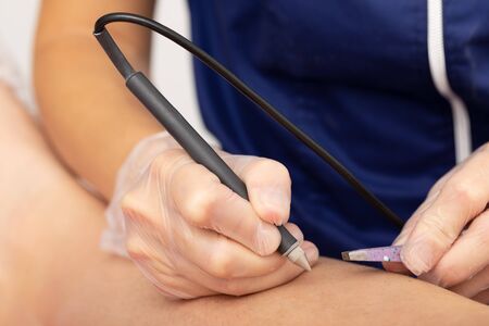 depilation of hair on the legs of the client with electricity. works cosmetologist. workflow detailの写真素材