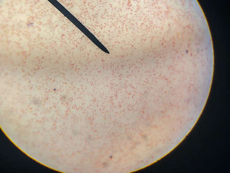 Morphology of bacteria (Esherichia coli) cell with gram strain technique under the 100x microscope view. Sample take from fecal of human.の写真素材