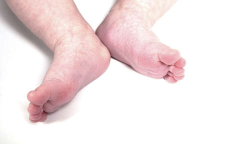 Baby feet on a white background.