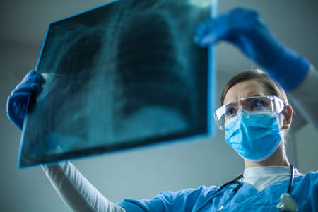 Female pulmonologist or oncologist holding chest X-ray scan,inspecting COVID-19 patient...