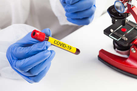 Lab scientist or medical technologist holding a yellow COVID-19 test tube blood sample vacutainer, Coronavirus infected patient specimen ready for microscope laboratory examination checkの写真素材