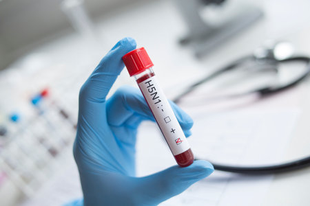 Blood sample for h5n1