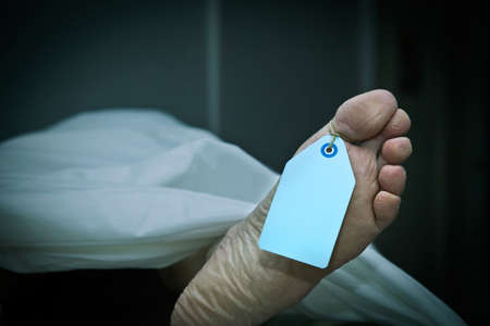 Closeup of foot in a morgue with blank tag hanging from the big toe. Foot clearly shows flaking skin and athlete's foot fungus as well as years of hard use. (body is a model)の写真素材