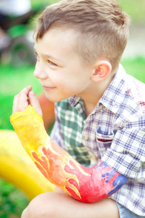 Portrait of boy with a broken arm on the outdoorの写真素材