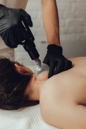 Hands of female chiropractor massaging back of young woman lying on massage table. Masseuse applying vacuum cup on loin of client. Concept of physical therapy treatment, neck pressure point.の写真素材