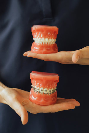 Close-up of dentist's hands showing dental treatment on artificial jaw. Tooth whitening, cleaning or...