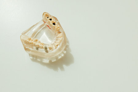 Artificial jaw with teeth and caries on a white background, teeth and dentist for dental care, appointment or checkup at clinic. Tooth whitening, cleaning or oral, mouth and gum care. Soft focus. Close-up.の写真素材