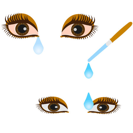 Vector graphics. Brown, reddened eyes with tears. Eye drops drip from a pipette into the eye.のイラスト素材