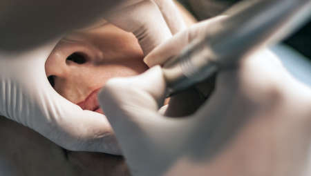 cosmetic injection plastic procedure face woman in the beauty salonの写真素材