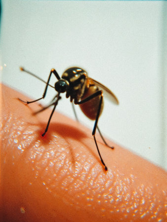 West Nile Virus Vector â Infected Mosquito on Human Skinの写真素材