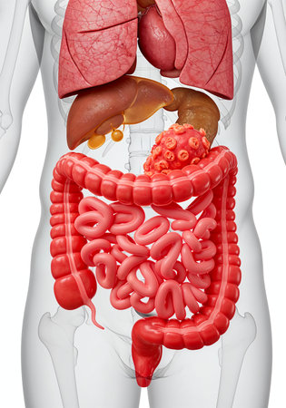 Colon Cancer Visualization in Human Digestive System
