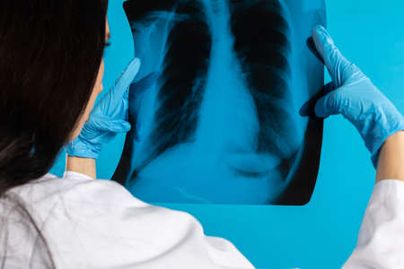 The pulmonologist checks the patient's lungs for any disturbing changes.の写真素材