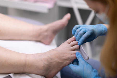 Work out the toenail plate with a disposable file.の写真素材