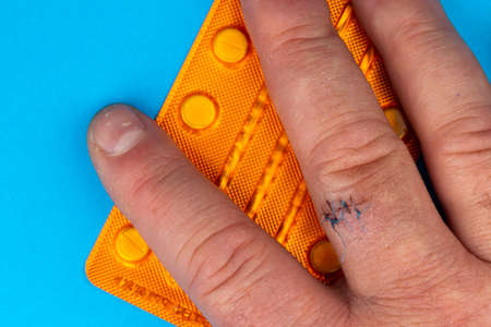 Postoperative sutures on the finger of the hand .. Stitches on the injured finger. Photo taken under...