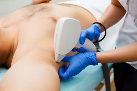 High Angle View Of A Therapist Giving Laser Epilation Treatment On Man's Armpitの写真素材