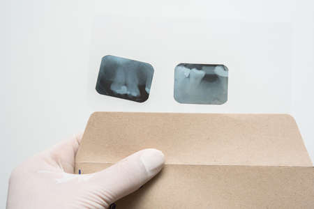hand hold a dental x-ray filmの写真素材