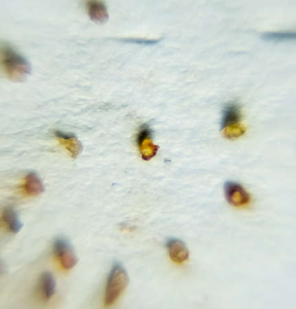Parasites on a sheet of paper. Extruded from the skin parasites. Acari parasites