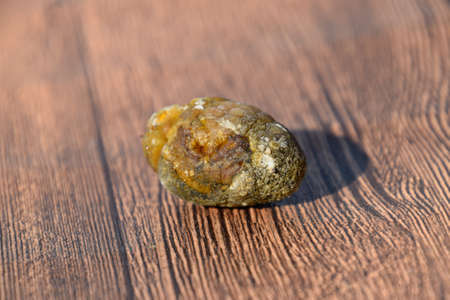 Stone of the gallbladder. The result of gallstones. A calculus of dissimilar composition on a wooden background.の写真素材