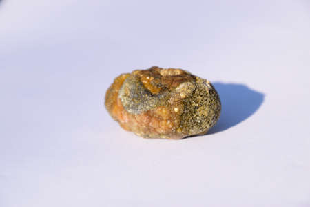 Stone of the gallbladder. The result of gallstones. A calculus of heterogeneous composition.の写真素材