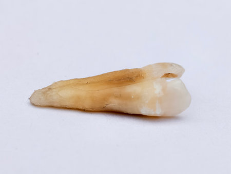 Pulled out cracked and damaged tooth, second premolar on a white background
