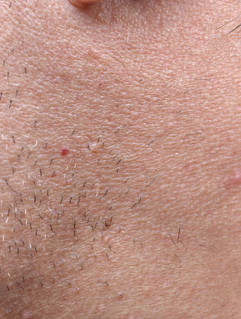 The skin of the man's face with stubble and flaky skin, sparse, gray hairs in the beard.