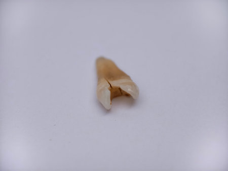 Pulled out, cracked and damaged tooth, second premolar on a white backgroundの写真素材
