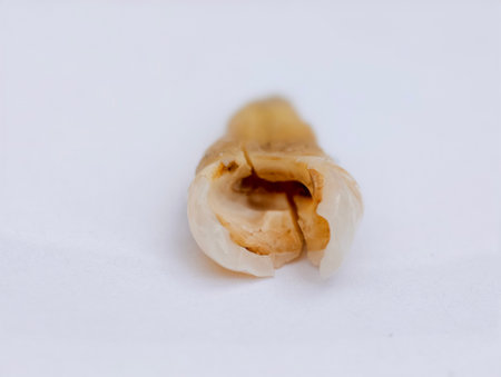Pulled out, cracked, and damaged tooth, second premolar on a white backgroundの写真素材