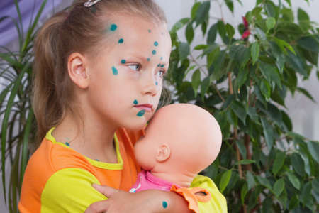 A girl child has chickenpox and is smeared with an antiseptic. Sad little girl hugging her favorite dollの写真素材