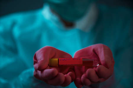 Coronavirus 2019-nCoV Blood Sample. Corona virus outbreaking. Epidemic virus Respiratory Syndrome.の写真素材
