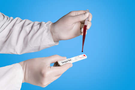 Doctor makes a Dengue Quick test with a pipetteの写真素材